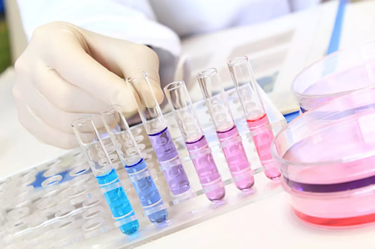 BiohemijskeanalizeZrenjanin1