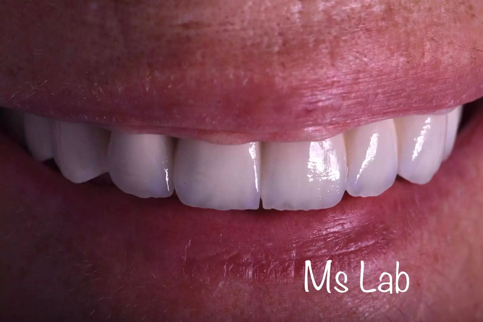 ImplantologijaiprotetikaBeogradZvezdara ImplantologijaiprotetikaBeogradZvezdara