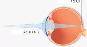 Operacija-katarakte-Niš1