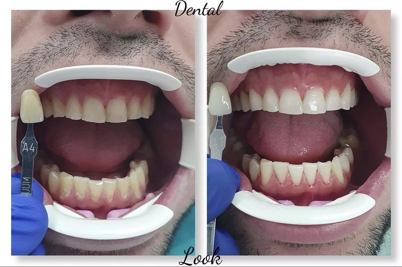 Proteti%C4%8DarskeuslugeVr%C5%A1ac5