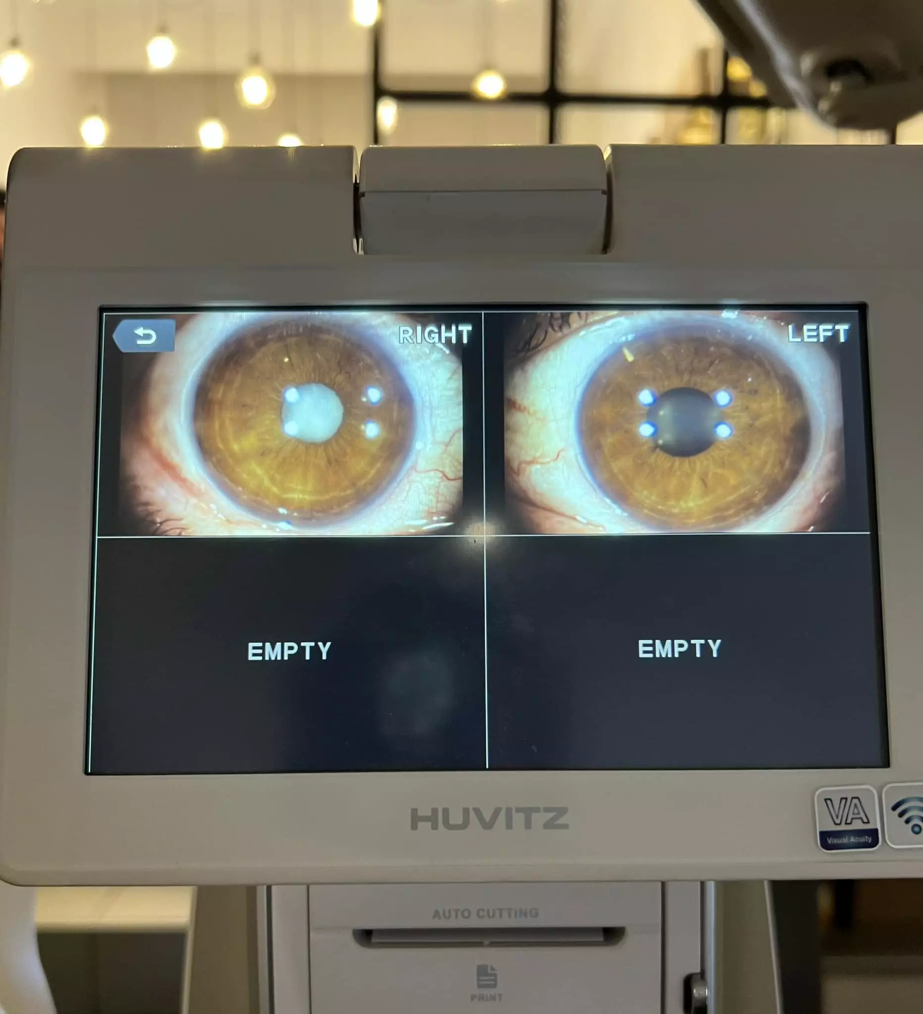 SkeneriultrazvukokaKragujevac6 SkeneriultrazvukokaKragujevac6