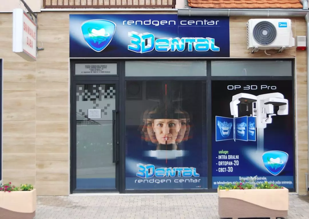 Snimanje-zuba-2d-i-3d-najpovoljnije-Kruševac5