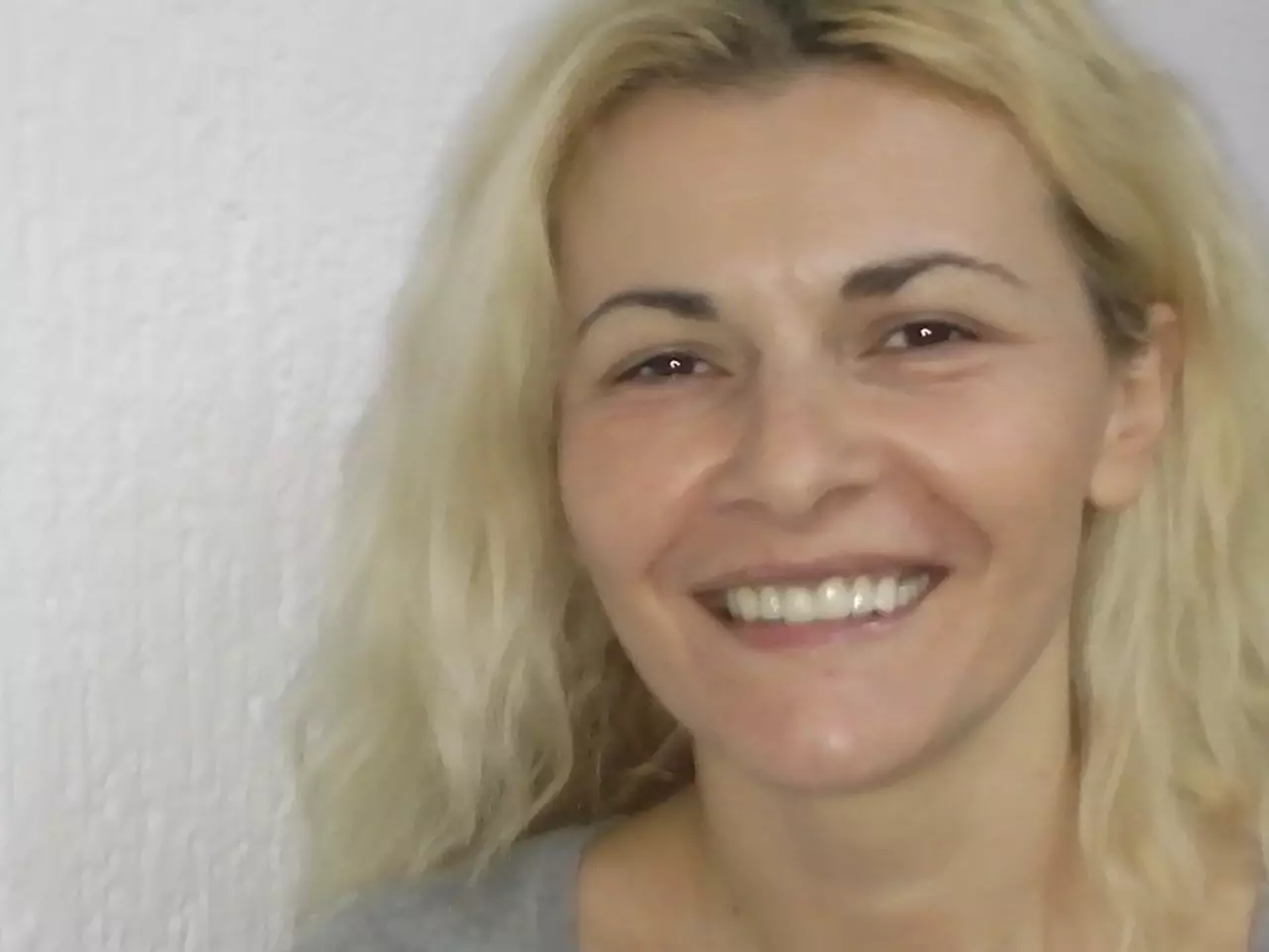 Specijalista-proteticar-Momir-Durlevic-Novi-Sad53 Specijalista-proteticar-Momir-Durlevic-Novi-Sad53