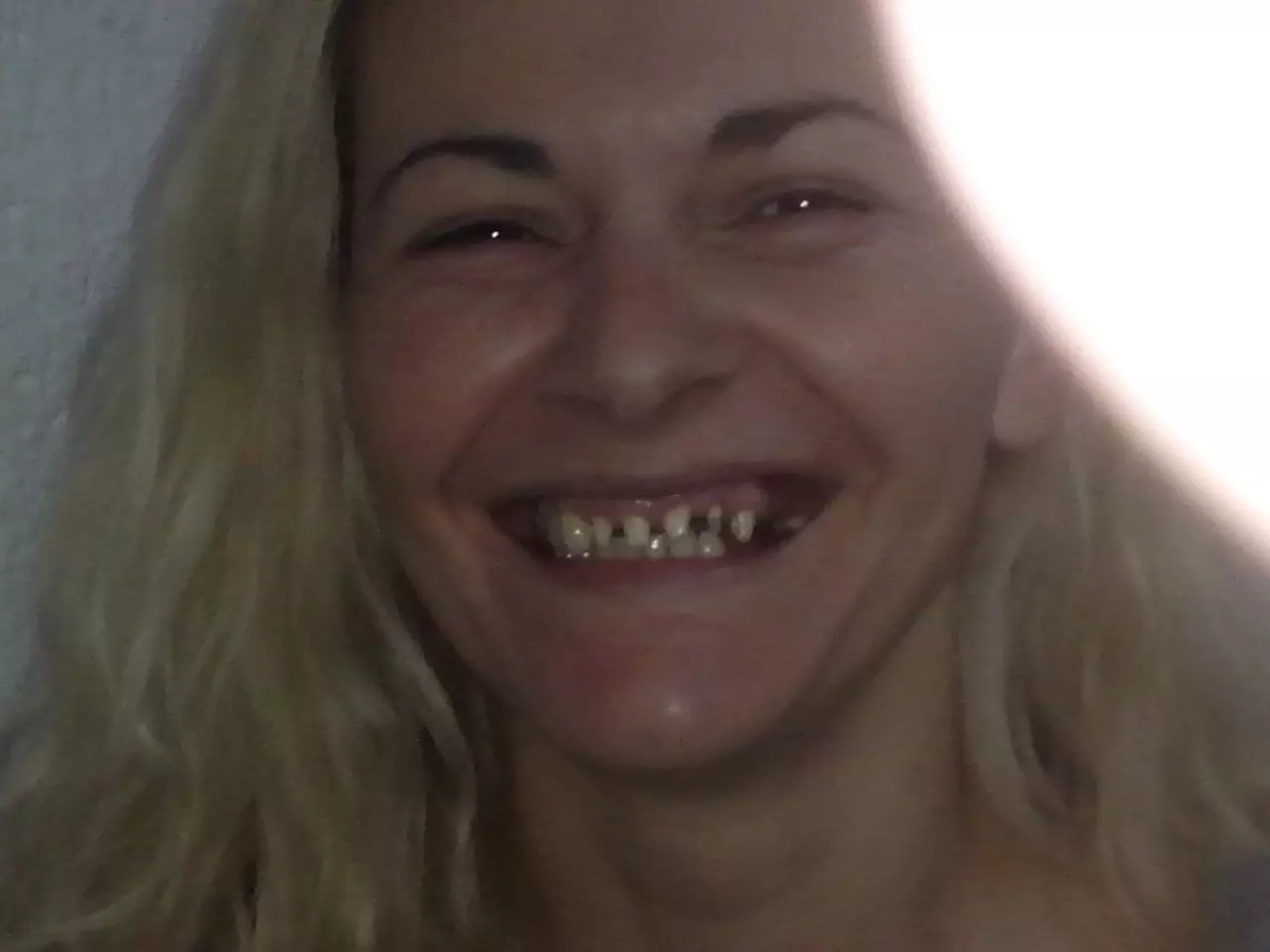Specijalista-proteticar-Momir-Durlevic-Novi-Sad77