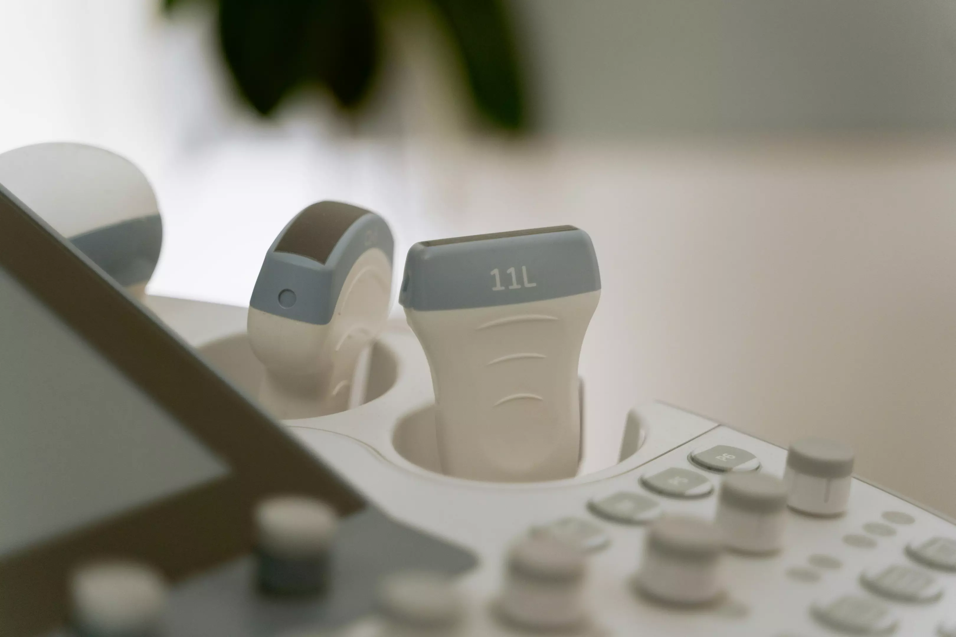 UltrazvukdojkeZrenjanin3