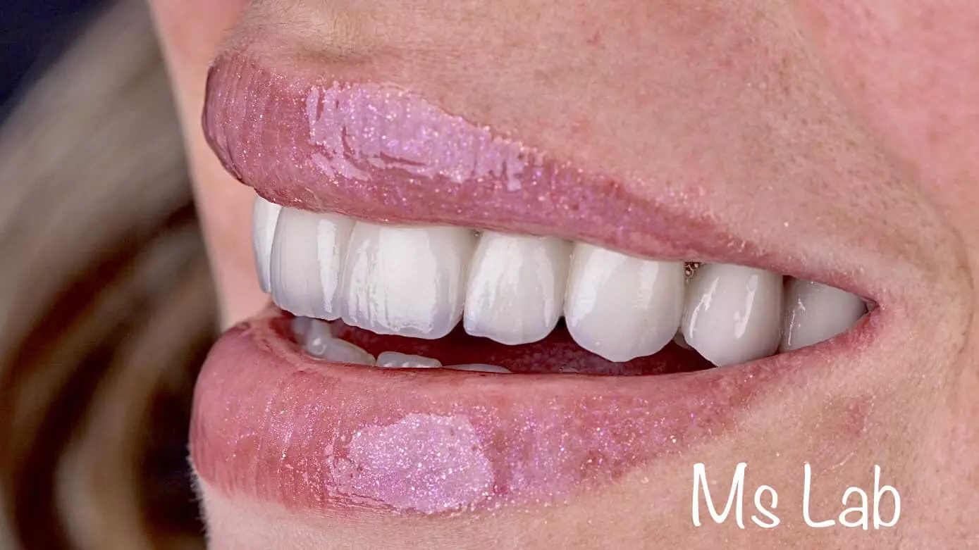 ZubnenavlakeBeogradZvezdara