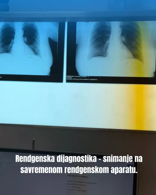 Pulmološka ordinacija Smederevo 3.jpg