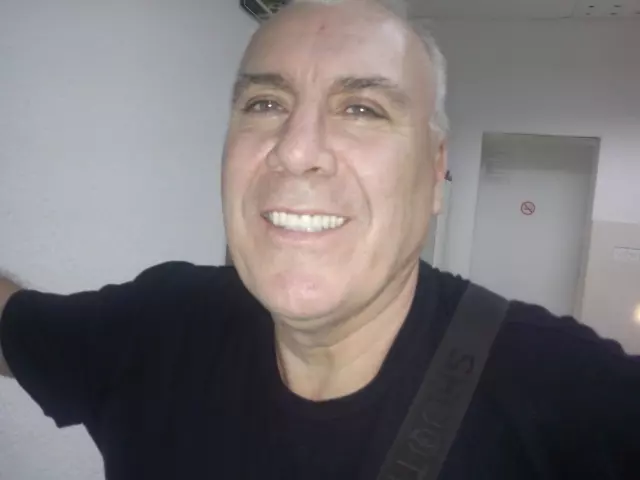 Specijalista proteticar Momir Durlevic Novi Sad  (51).jpg