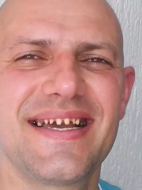 Specijalista proteticar Momir Durlevic Novi Sad  (52).jpg