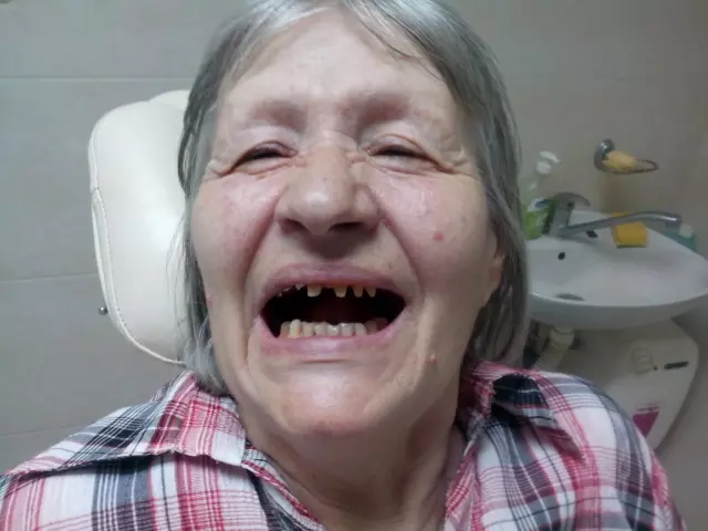 Specijalista proteticar Momir Durlevic Novi Sad  (65).jpg