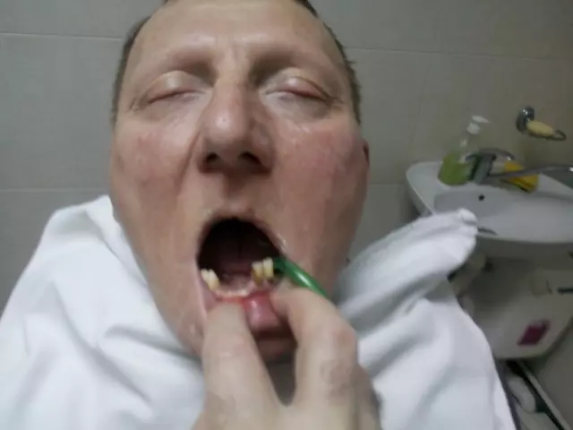 Specijalista proteticar Momir Durlevic Novi Sad  (7).jpg