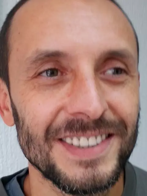 Specijalista proteticar Momir Durlevic Novi Sad  (97).jpg